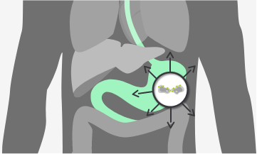 CLDN18.2 expresada en metástasis ganglionares del adenocarcinoma gástrico y en otras localizaciones metastásicas